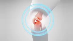 Giải pháp mới thay thế phẫu thuật giúp giảm đau do thoái hóa khớp tới 1 năm