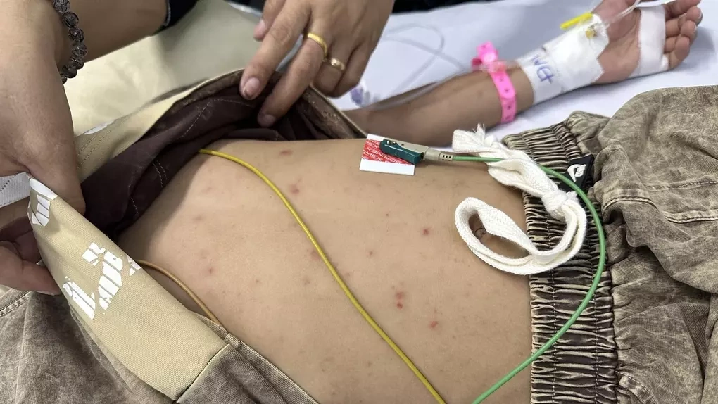 Bệnh nhi mắc não mô cầu điều trị tại TP HCM. Ảnh: Bệnh viện cung cấp