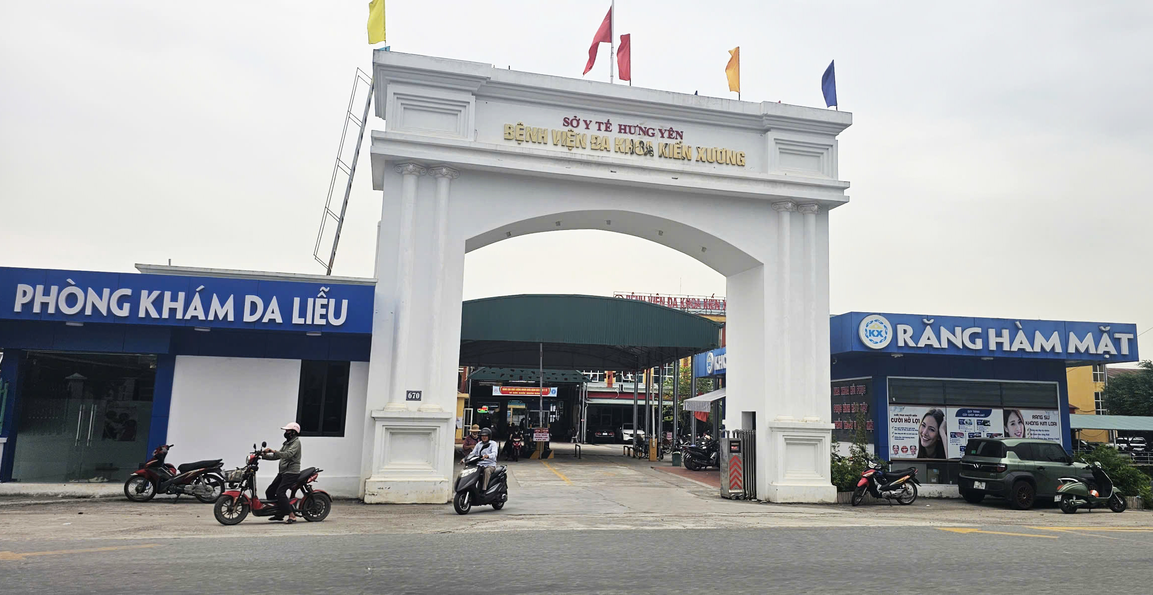 Nữ bệnh nhân sau mổ Phaco mắt phải tại Bệnh viện Đa khoa Kiến Xương, tỉnh Hưng Yên được xác định mất thị lực vĩnh viễn, phía bệnh viện và gia đình đang bất đồng về nguyên nhân - Ảnh: TIẾN THẮNG