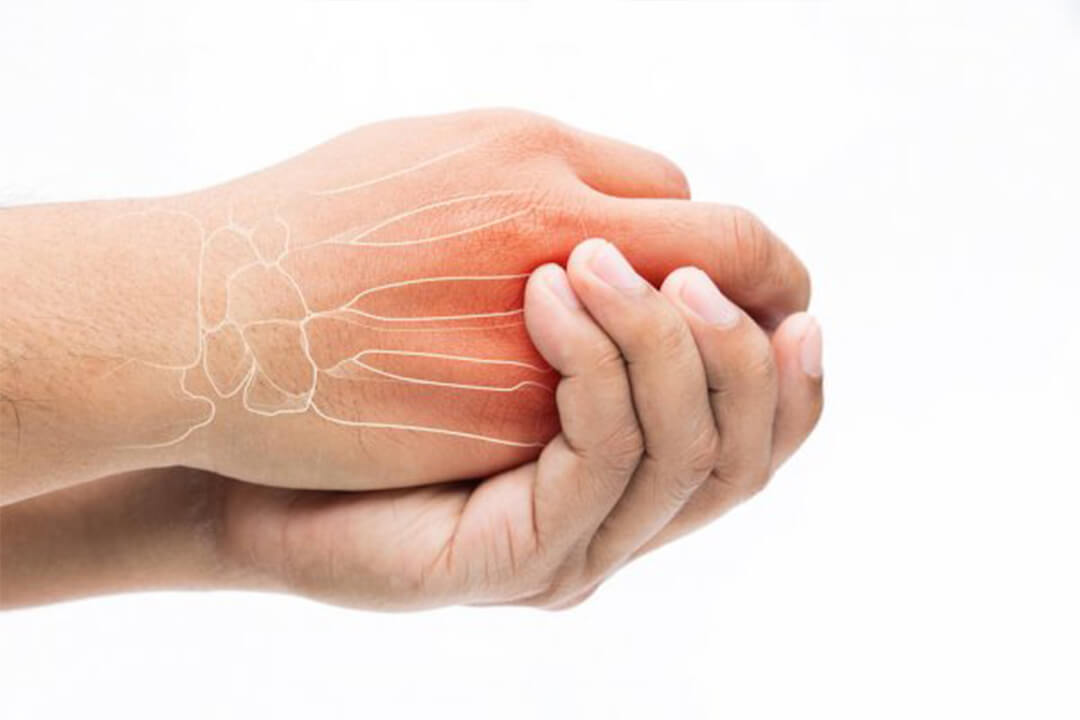 Nếu tê tay tái diễn mà không rõ lý do, bác sĩ sẽ căn cứ vào tiền sử sức khỏe, thuốc đang dùng, khám lâm sàng và các xét nghiệm cần thiết để tìm nguyên nhân. Không nên tự ý uống vitamin hoặc khoáng chất với hy vọng hết tê khi chưa xác định được vấn đề - Ảnh: AI