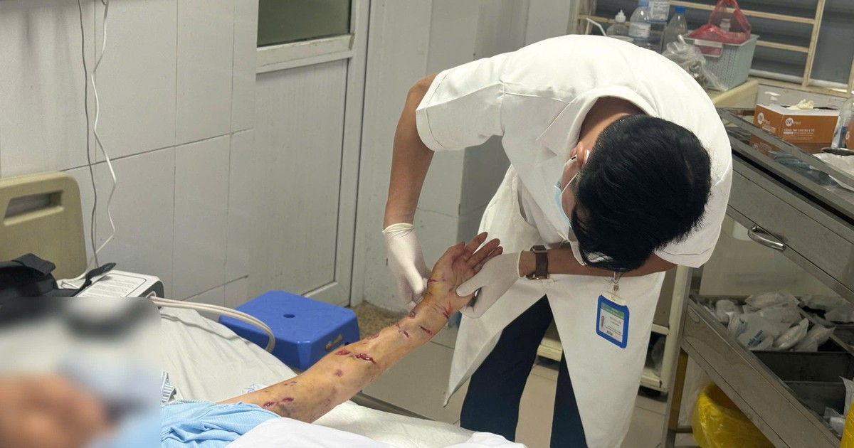 Nằm liệt giường, cụ bà 76 tuổi vẫn bị chó nhà tấn công phải nhập viện