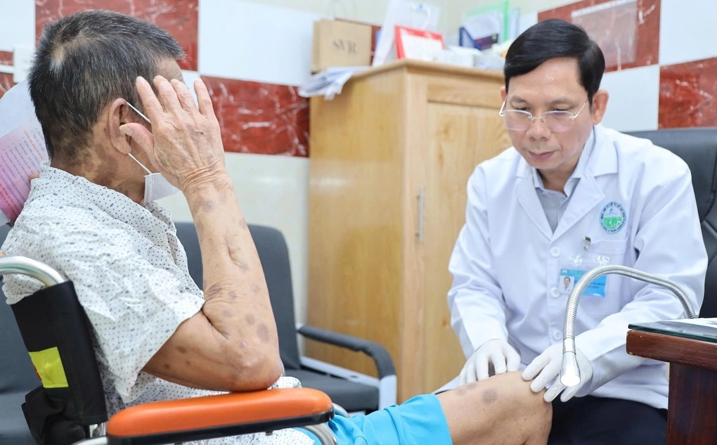 Bác sĩ Lợi Em thăm khám cho người bệnh đau kéo dài sau zona tại Bệnh viện Da Liễu TP HCM. Ảnh: Bệnh viện cung cấp