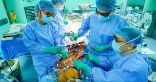 Không triệu chứng, người đàn ông 43 tuổi bất ngờ phát hiện hở van tim nặng