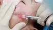 Tiêm botox, filler giả có thể gặp biến chứng gì?