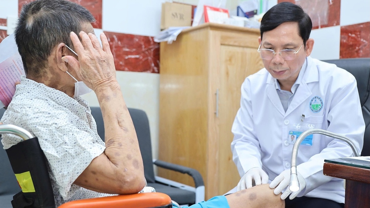 'Ác mộng' đau thần kinh sau khi bệnh zona lành