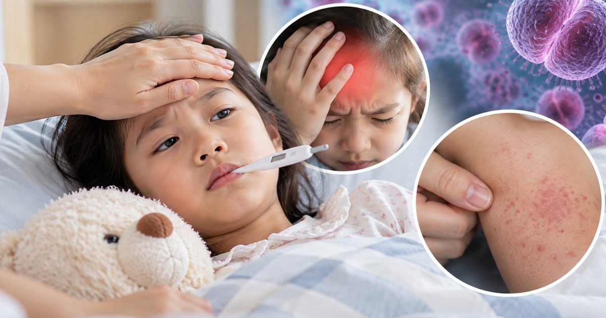 Não mô cầu: Khi nào cần cảnh giác với sốt, đau đầu, phát ban?
