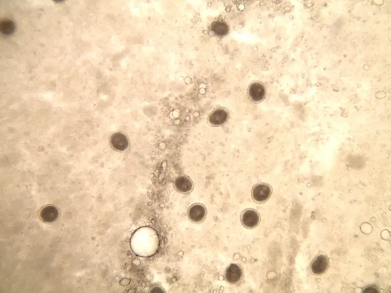Trứng giun đũa (Toxocara canis) dưới kính hiển vi được tìm thấy trong phân của chó