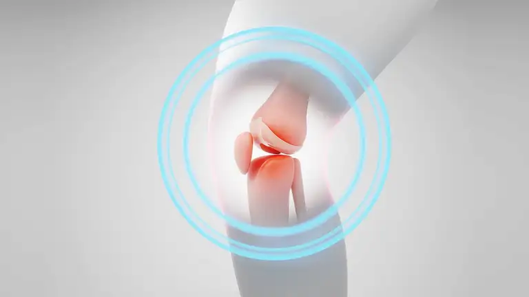 Thủ thuật thuyên tắc động mạch gối, viết tắt là GAE, đang trở thành một hướng đi mới thu hút sự chú ý của giới chuyên môn. Ảnh minh họa: Younify Clinic