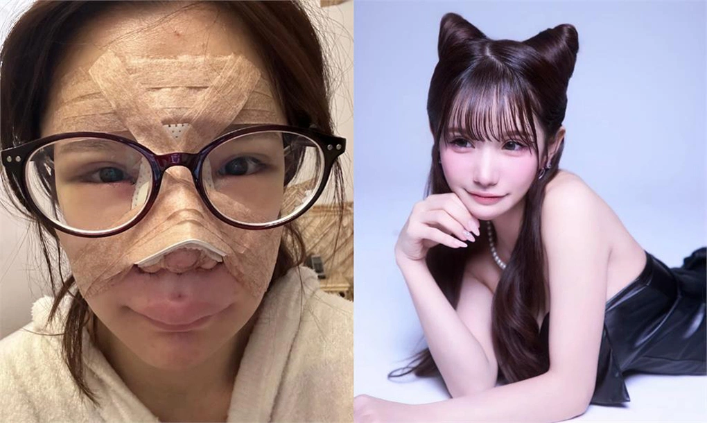 Hirase từng phải làm nhiều công việc và tiết kiệm tiền trong nhiều năm để phẫu thuật thẩm mỹ. Ảnh: X Nyairin_18