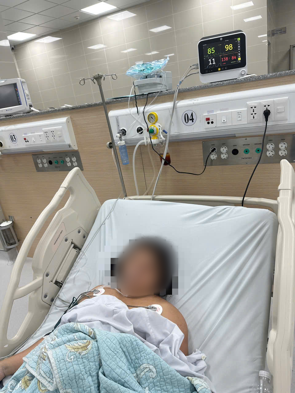 Theo thông tin ban đầu, sản phụ bị phù hai chân nhiều ngày, ho và khó thở trong hai ngày trước khi nhập viện, đồng thời không khám thai định kỳ - Ảnh: M.T.