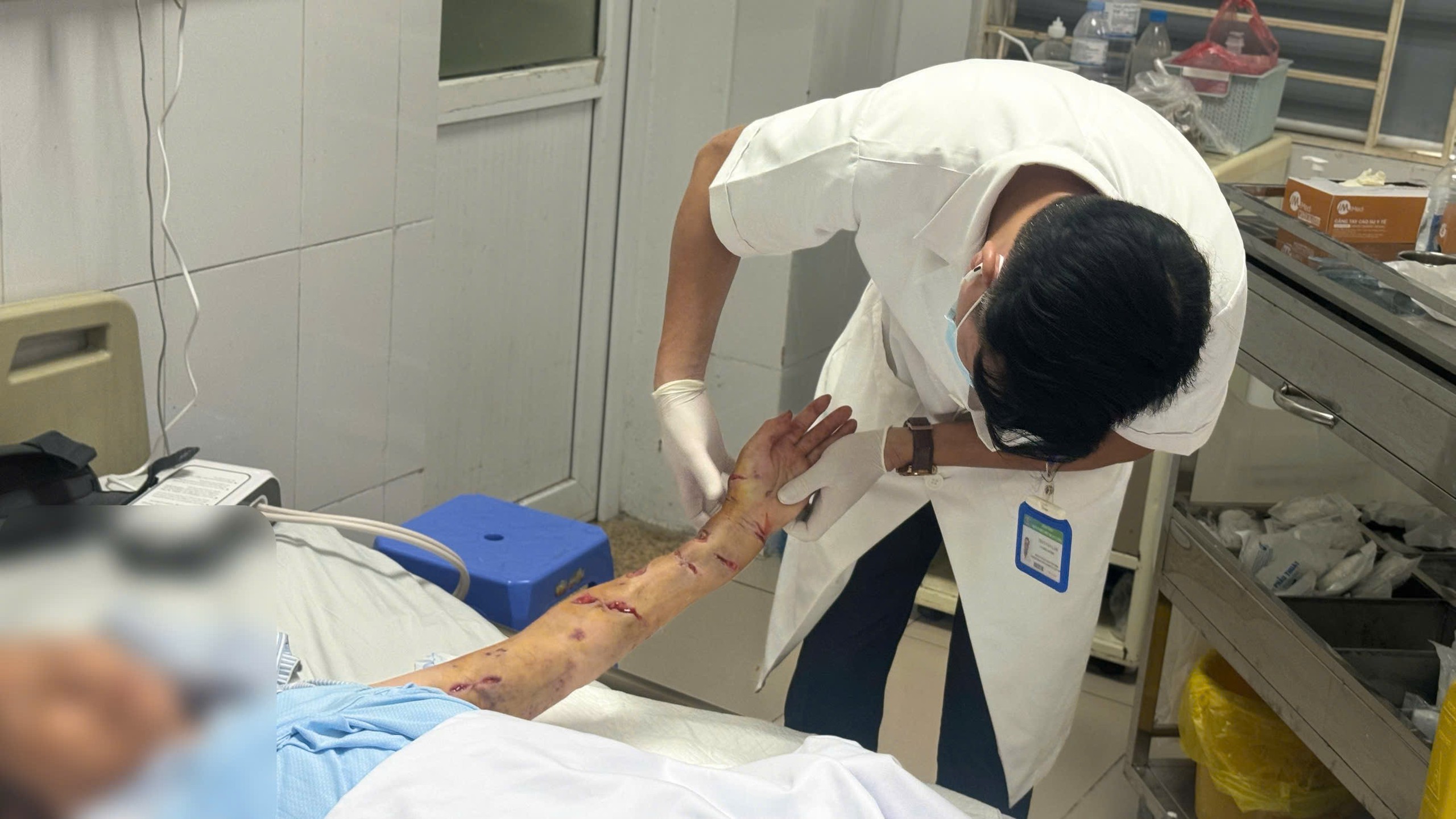 Bác sĩ Bệnh viện Bệnh nhiệt đới Trung ương xử lý vết thương cho người bệnh - Ảnh: BVCC