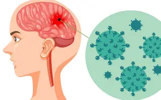 Bệnh não mô cầu nguy hiểm thế nào, phòng bệnh ra sao?