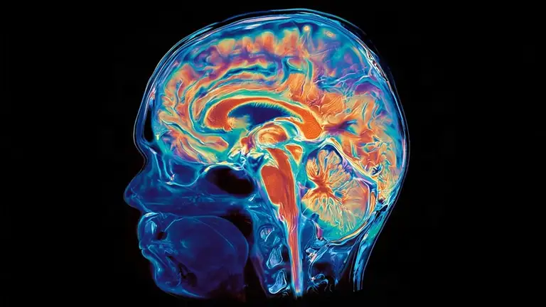 Các phần của não bộ phát triển từ các nguồn khác nhau - Ảnh: AI/SCIENCEDAILY.COM